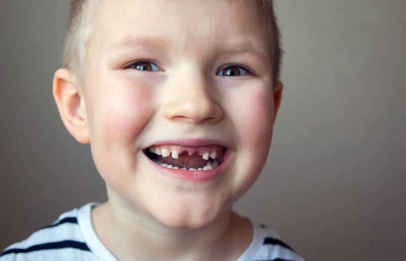 kind zonder tanden