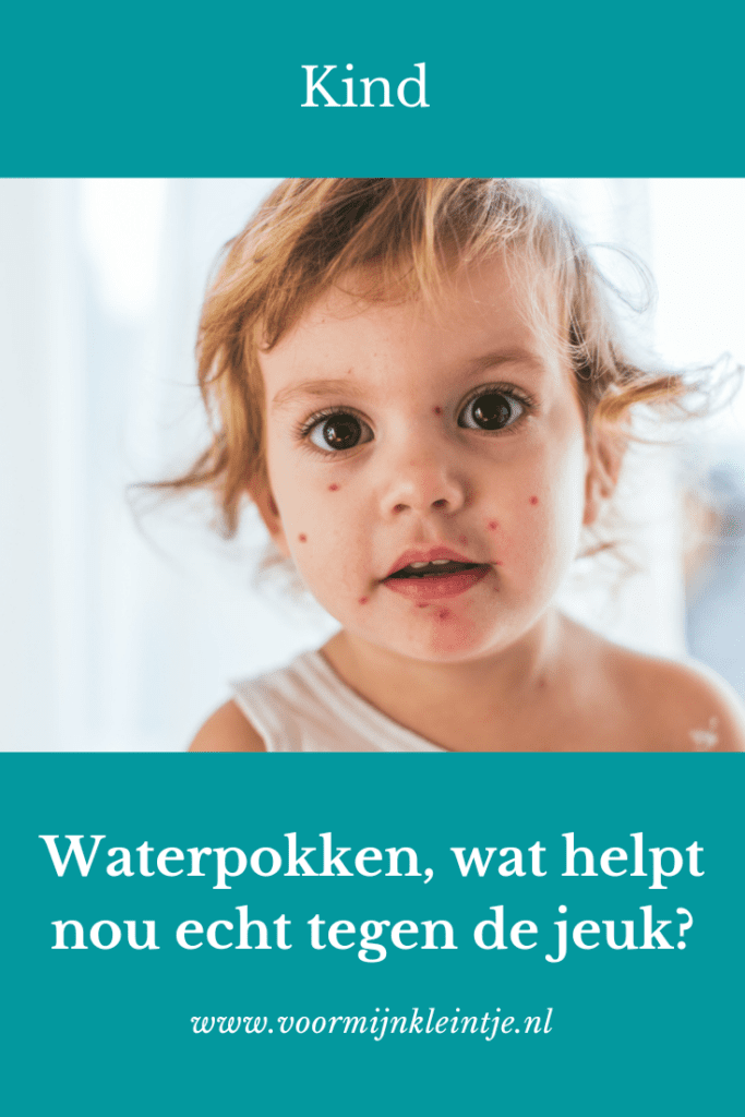 wat helpt jeuk waterpokken