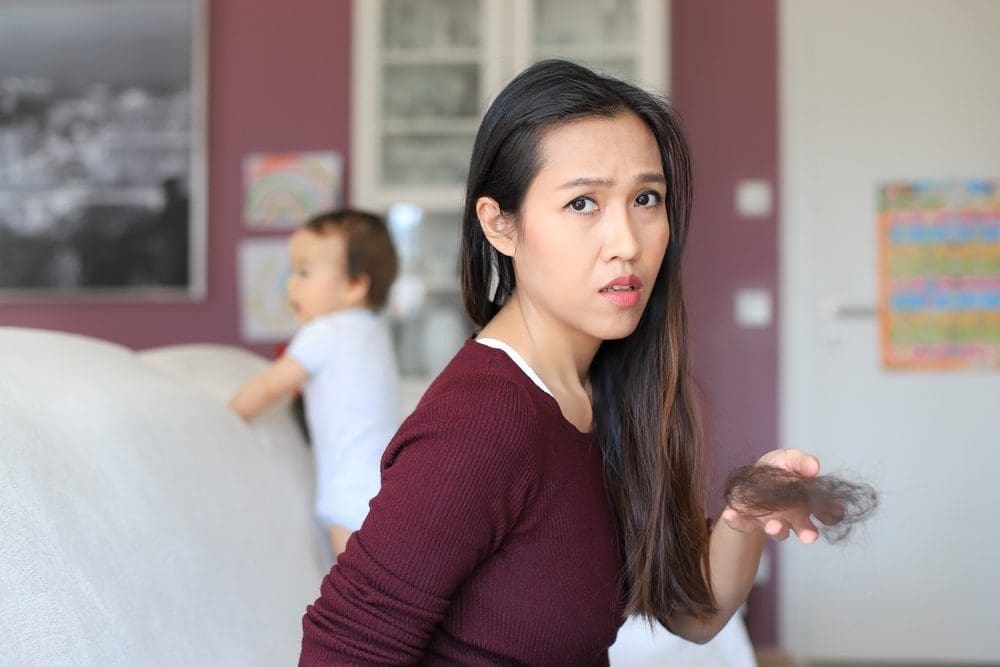 Haarverlies na de zwangerschap