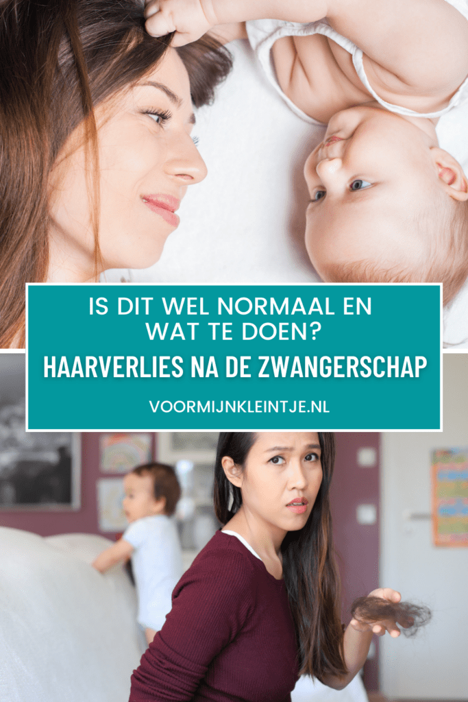 Haarverlies na de zwangerschap